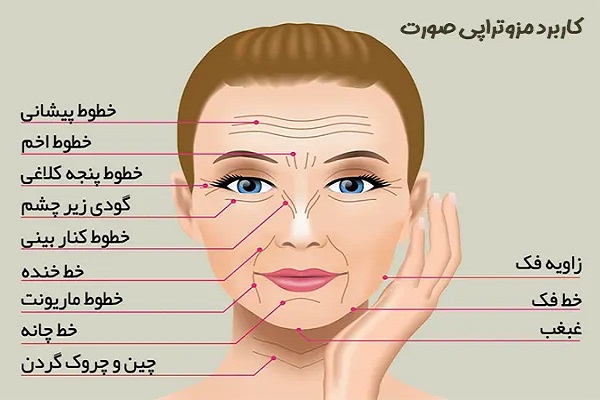 مزوتراپی در پاسداران تهران
